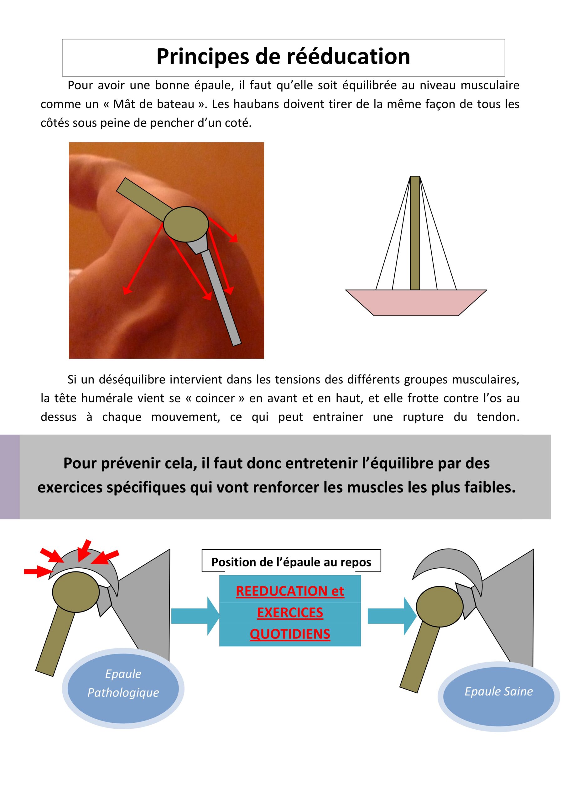Principes de rééducation de l'épaule